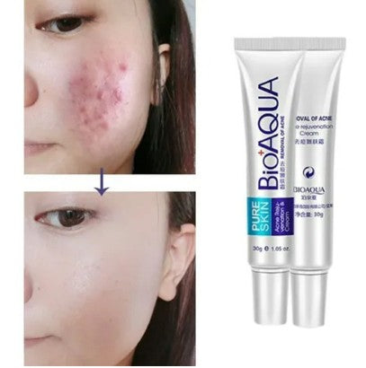 CREMA ANTIACNE BIOAQUA