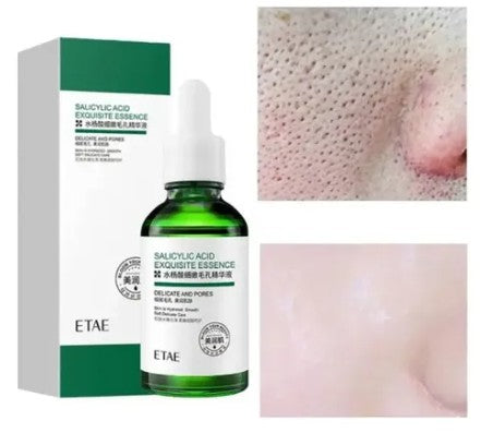 SERUM ACIDO SALICILICO